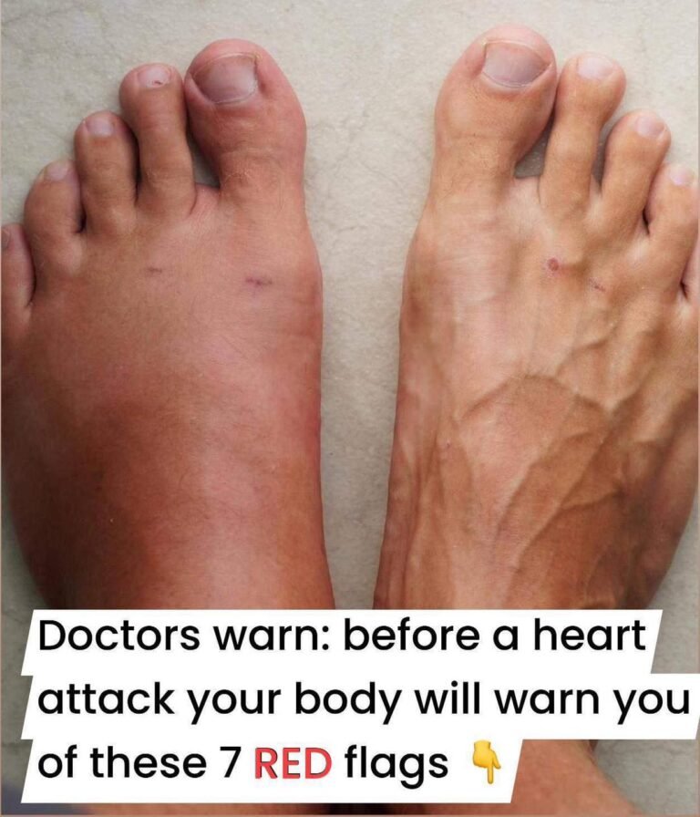 One Month Before A Heart Attack, Your Body Will Warn You Of These 7 Signs