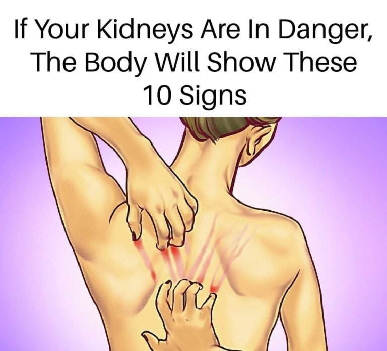 If Your Kidneys Are in Danger, the Body Will Show these 10 Signs